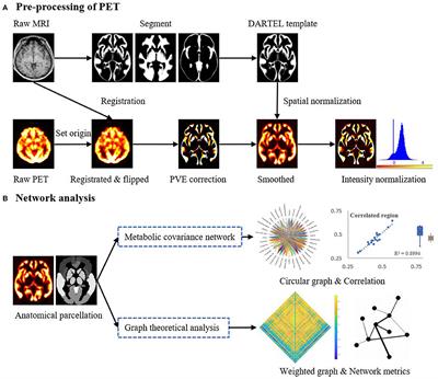 Aberrant Metabolic Patterns Networks in Insular Epilepsy